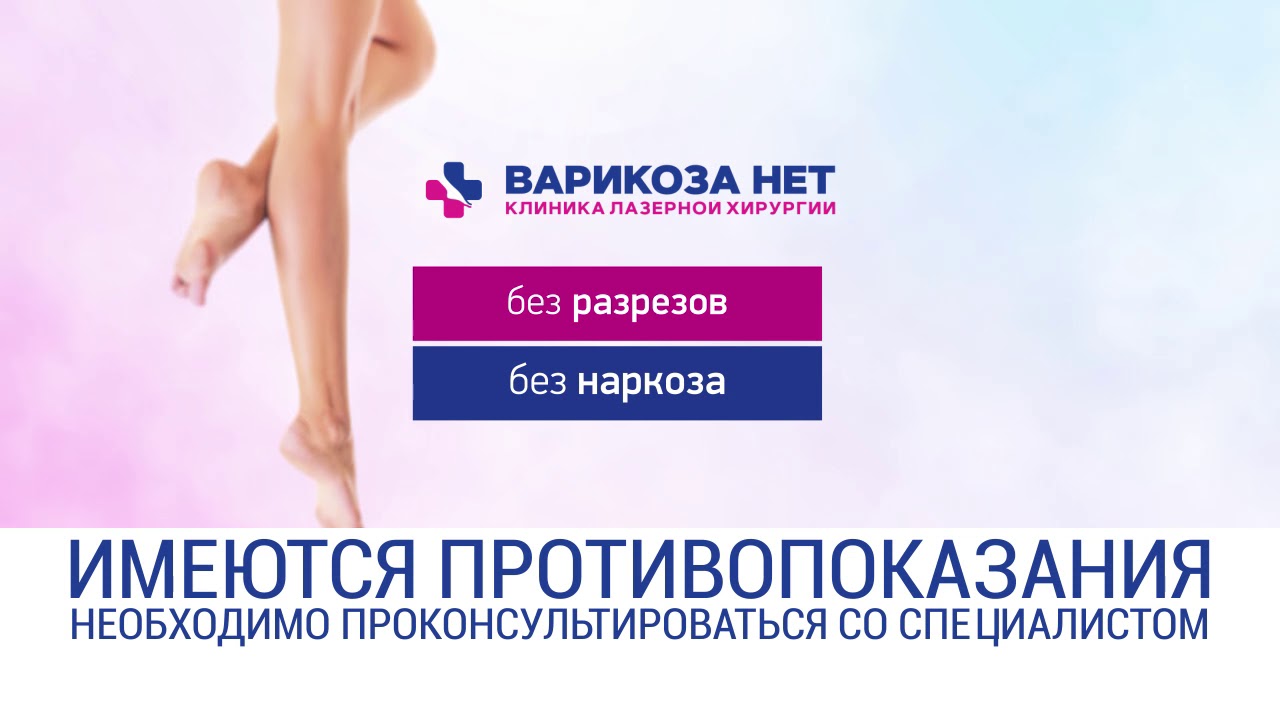 Варикоза Нет  Казань