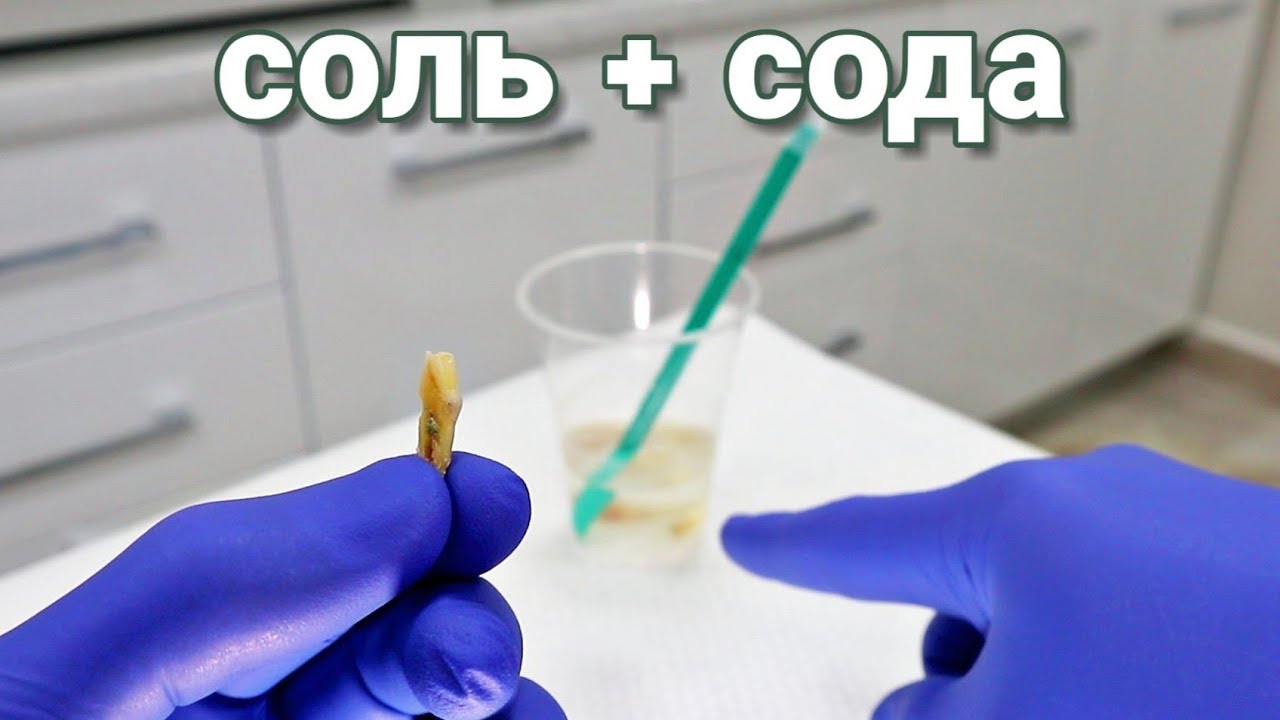 Идеальные Зубы. Соль+Сода