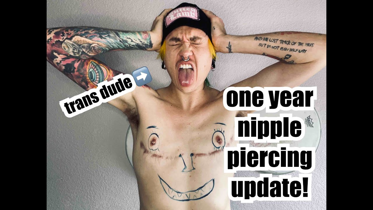 TRANS DUDE ONE YEAR NIPPLE PIERCING UPDATE