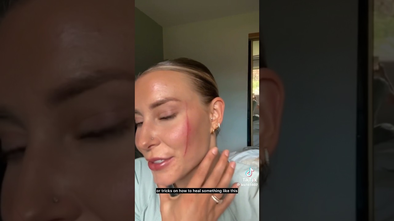 Dermatologist Explains: Facial Scar Management