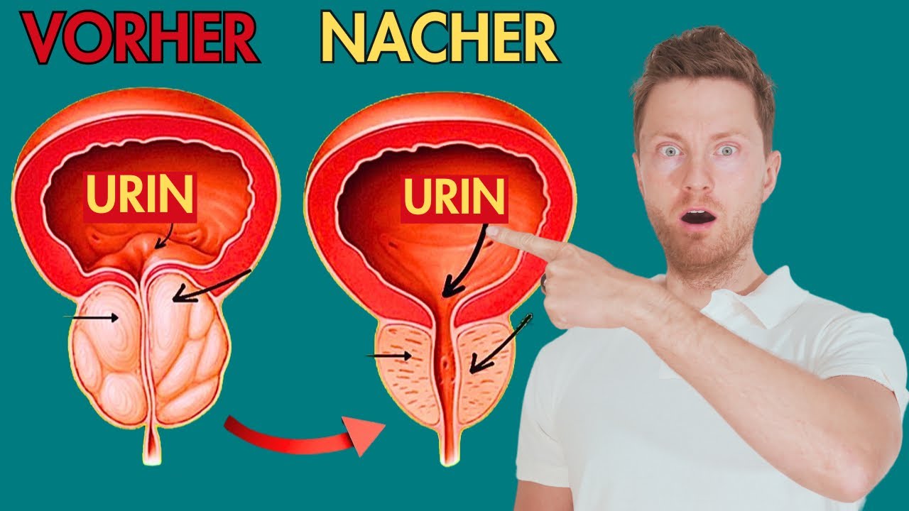 BECKENBODENTRAINING FÜR MÄNNER 💪: Die 4 EFFEKTIVSTEN ÜBUNGEN für eine GESUNDE PROSTATA!