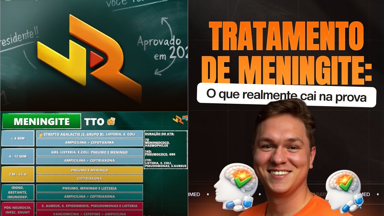 COMO TRATAR MENINGITE - Tratamento da meningite: como aparece na prova! | VRMED