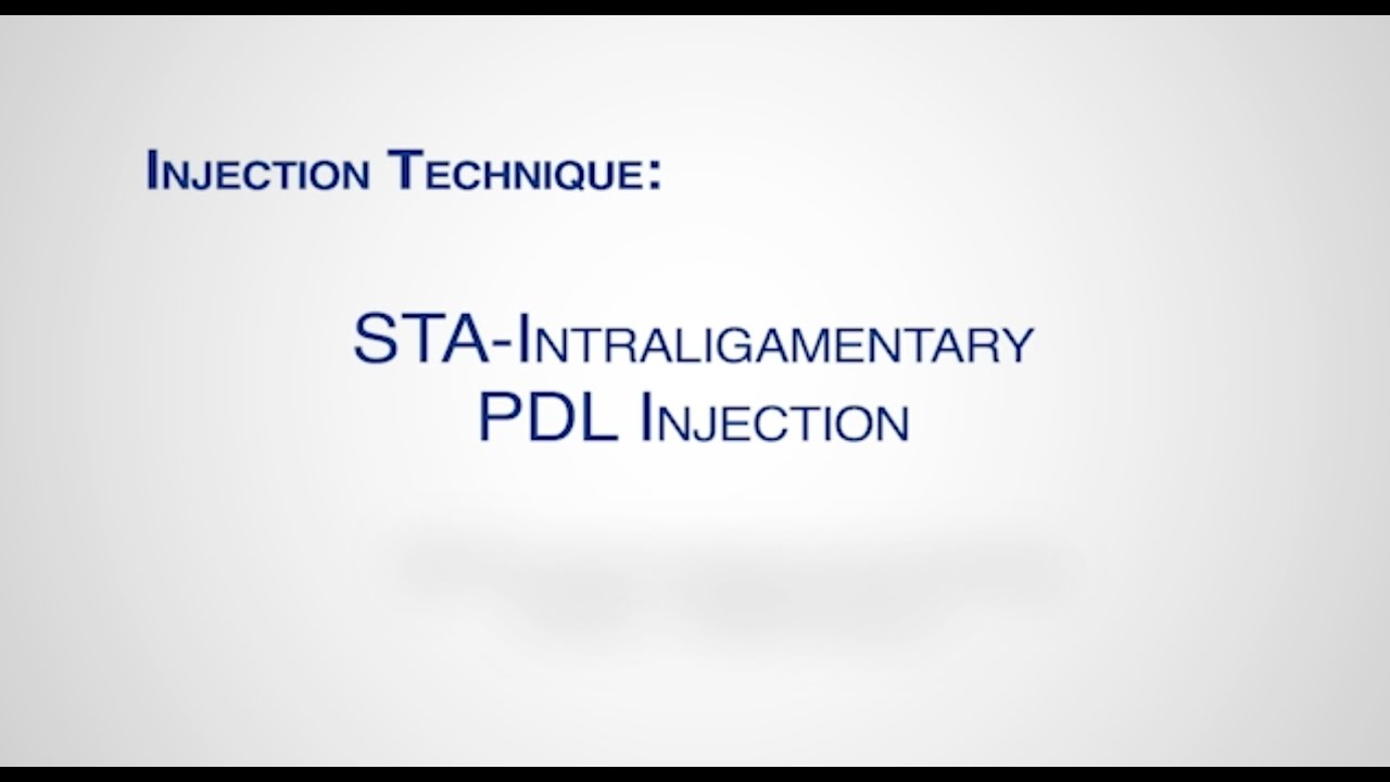 Module: STA Intraligamentary Injection