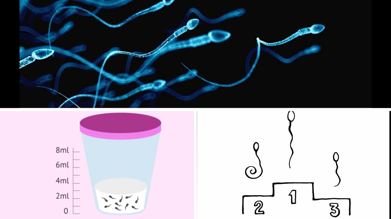 قراءة كاملة لتحليل السائل المنوي مع شرح جد مبسط Spermogramme
