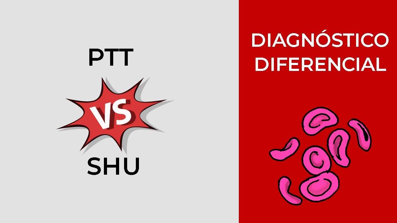 Diagnóstico Diferencial Púrpura Trombótica vs Síndrome Hemolítico Urémico