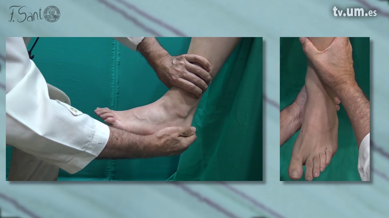 Diagnóstico de las lesiones ligamentosas externas