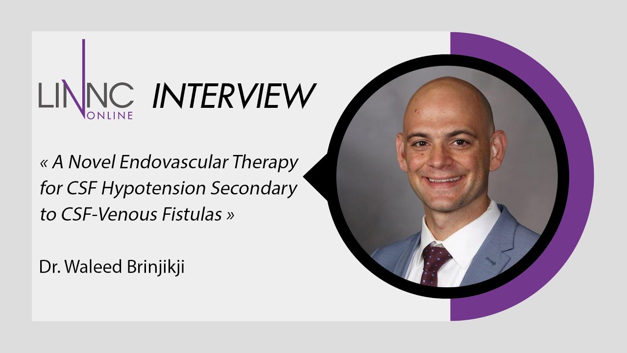 Waleed Brinjikji interview_Endovascular Therapy for CSF Hypotension Secondary to CSF-Venous Fistulas