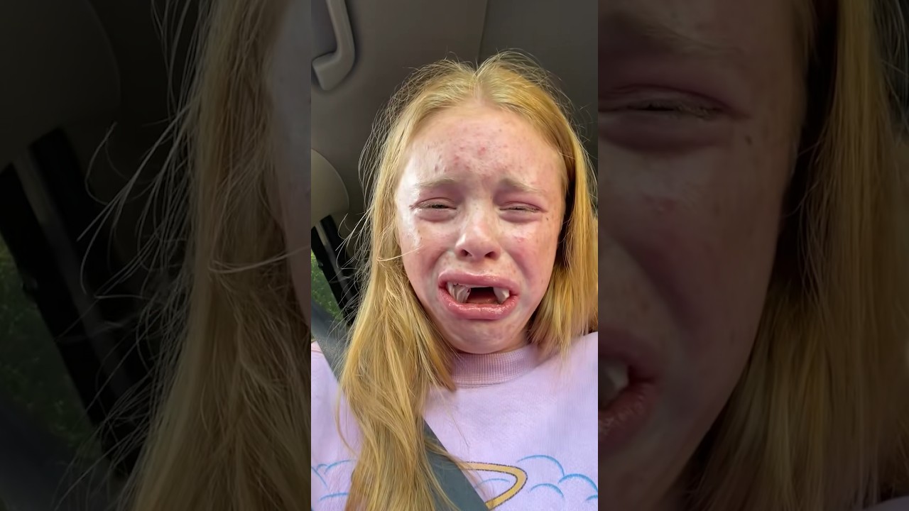 Why Getting Wisdom Teeth Removed Can Get You In TROUBLE!