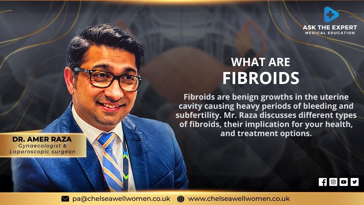 What are Fibroids