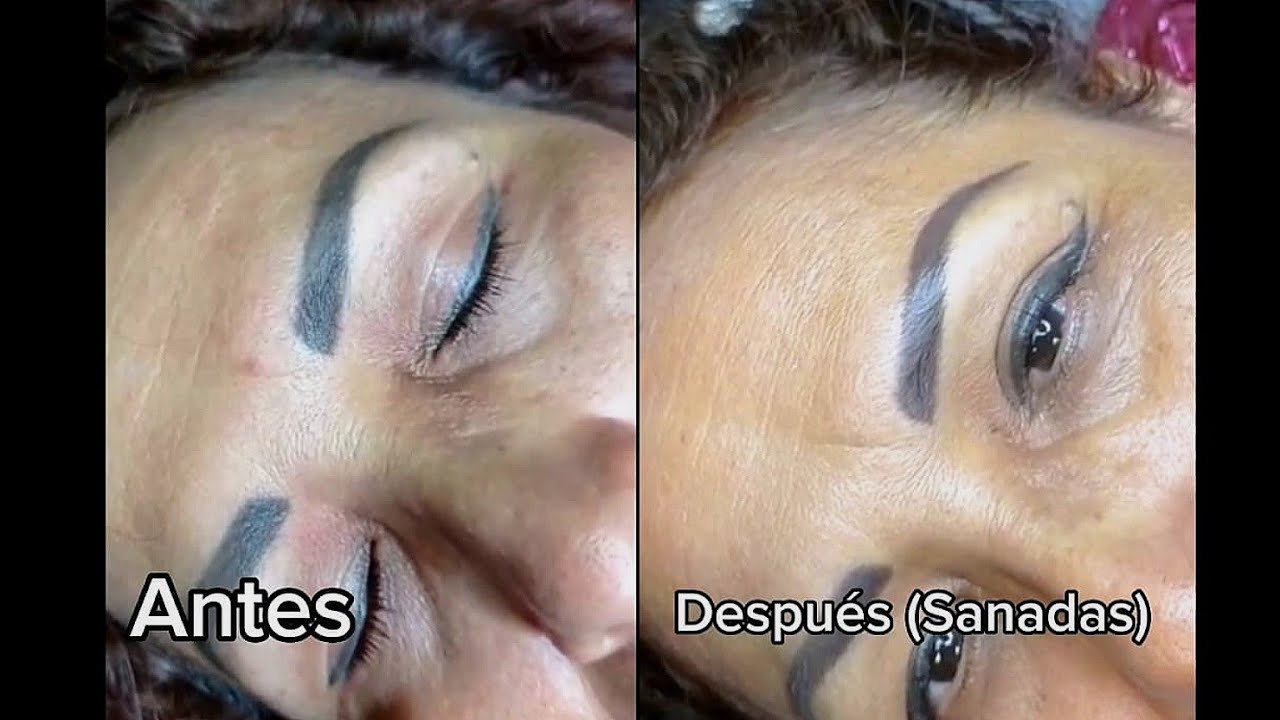 Corregir color de cejas tatuadas negras o muy oscuras..