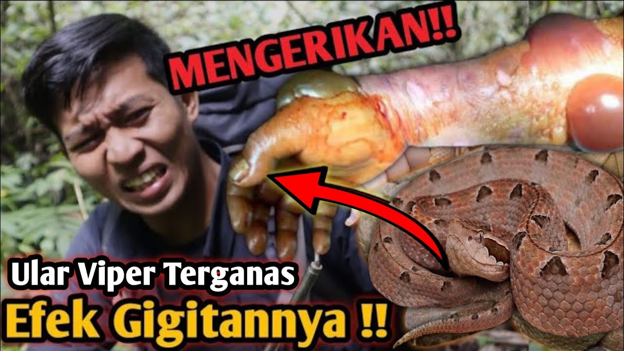 PARAH! EFEK GIGITAN ULAR INI BISA SANGAT MENGERIKAN! HATI HATI ULAR BERBISA DISEKITAR KITA!