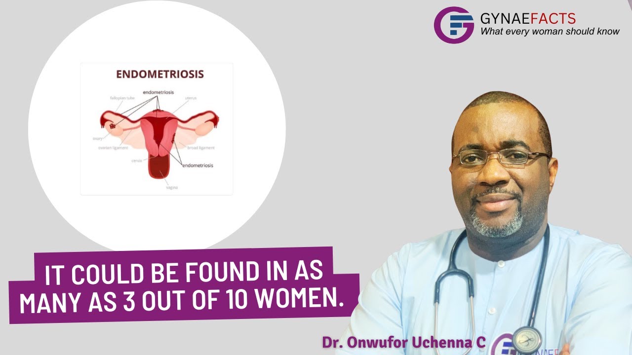 ENDOMETRIOSIS: How It can cause severe pain in the pelvis and make it harder to get pregnant.