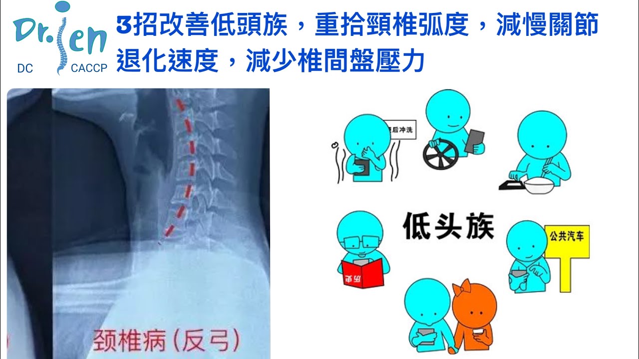 3招改善低頭族，重拾頸椎弧度，減慢關節退化速度，減少椎間盤壓力。3Steps help get neck curve back, decrease degeneration & disc stress