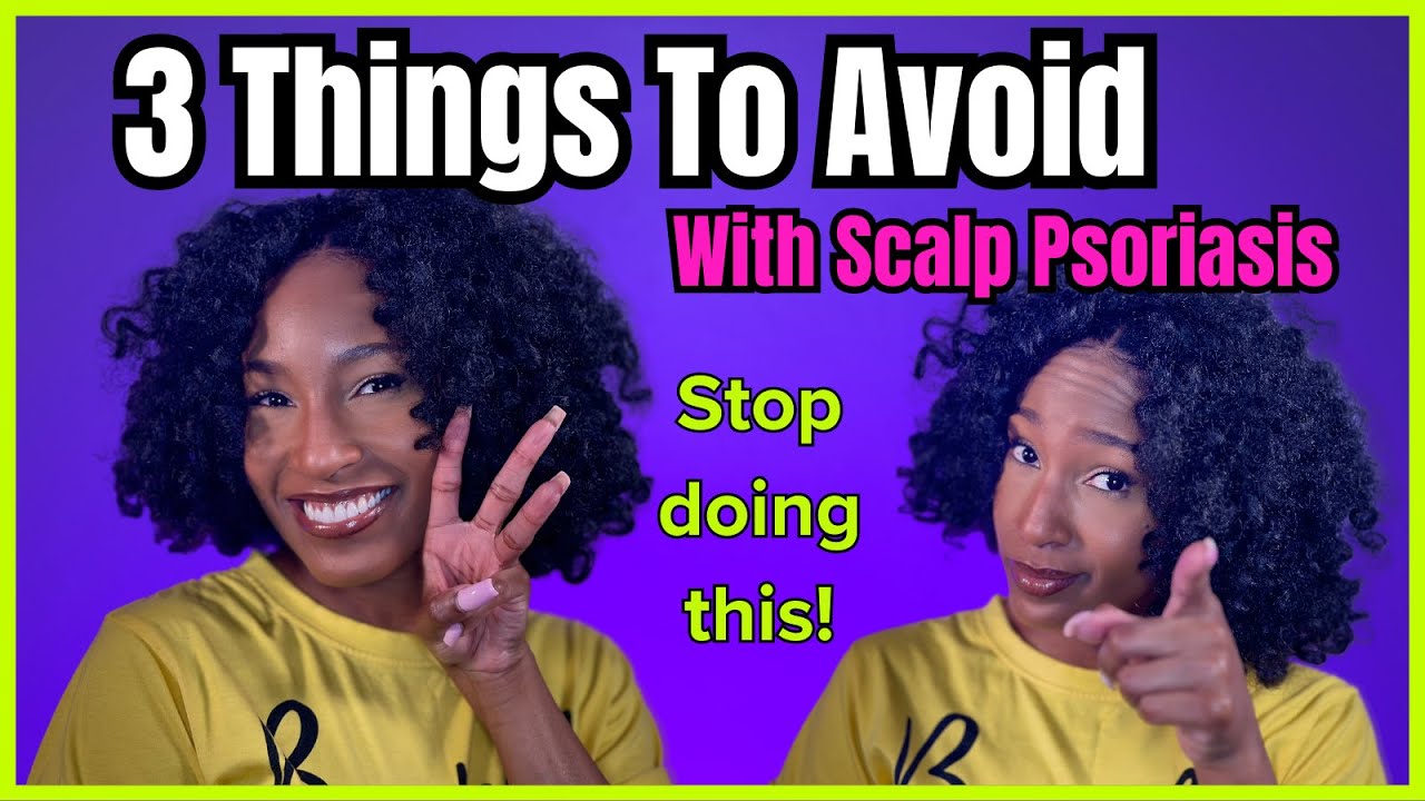 3 Things To Avoid When Treating Scalp Psoriasis | How to Begin Healing Your Psoriasis Scalp