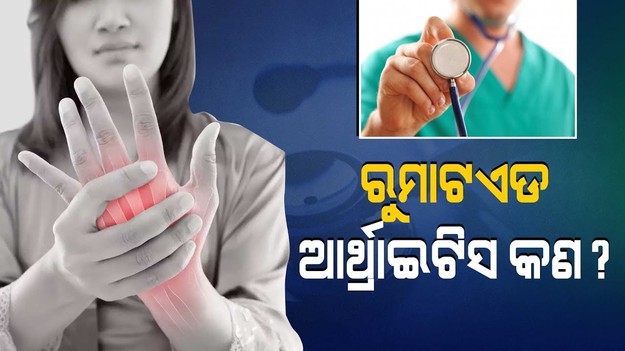 Doctor Doctor | Causes & Treatment Of Arthritis