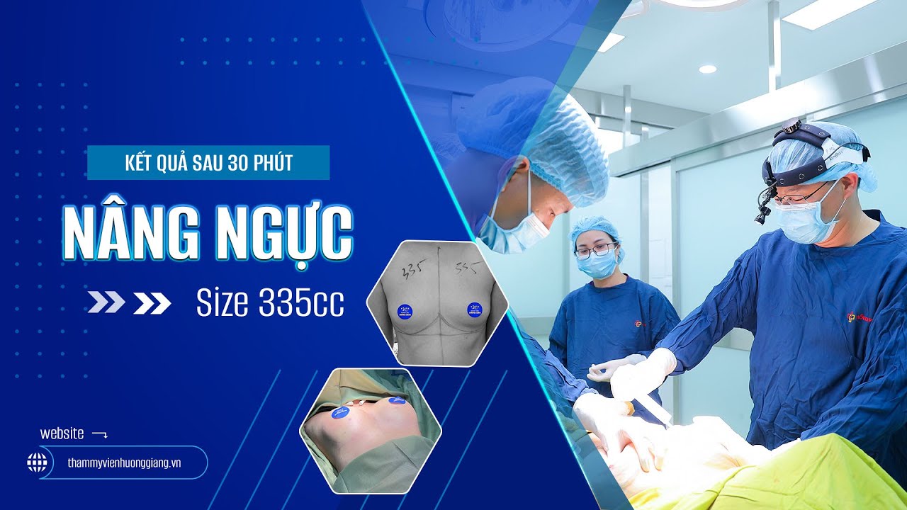 Kết quả sau 30 phút nâng ngực không nghỉ dưỡng | Ths. bs Bùi Văn Cường