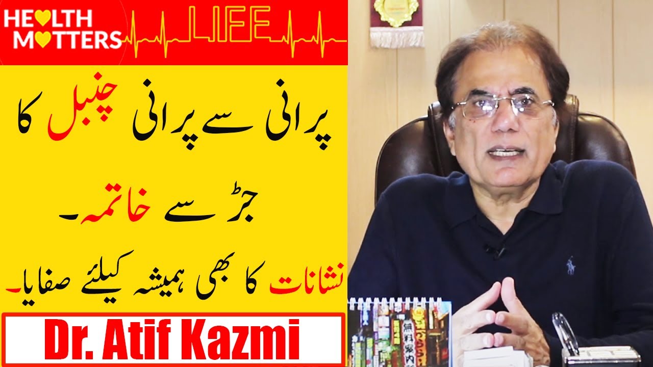 Chambal Ka llaj | Eczema Ka Ilaj | How To Treat Eczema | Eczema Treatment | Dr atif kazmi