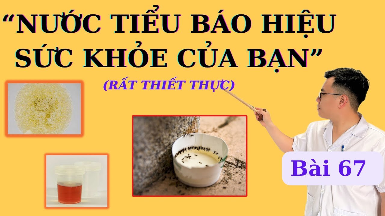 “5 GIÂY QUAN SÁT NƯỚC TIỂU”, siêu tiết kiệm tiền xét nghiệm, phát hiện ngay bất thường rất đơn giản