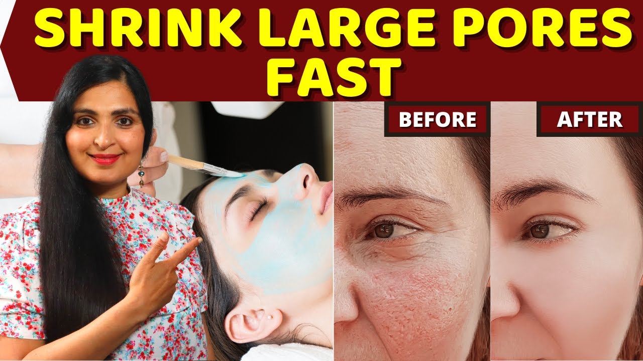 DIY Tomato Facial for Clear & Glowing Skin | Instant OPEN PORES Removal |100% Results |  #OpenPores