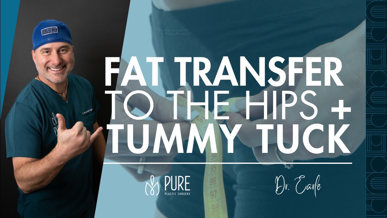 Fat Transfer to the Hips + Tummy Tuck: A Powerful Combination