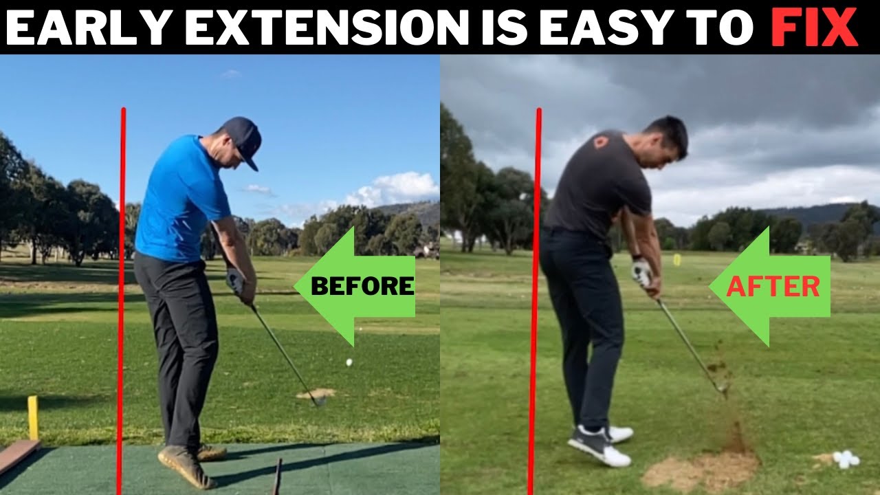 He Easily Fixed His Early Extension In 1 Month Following This Breakthrough Plan