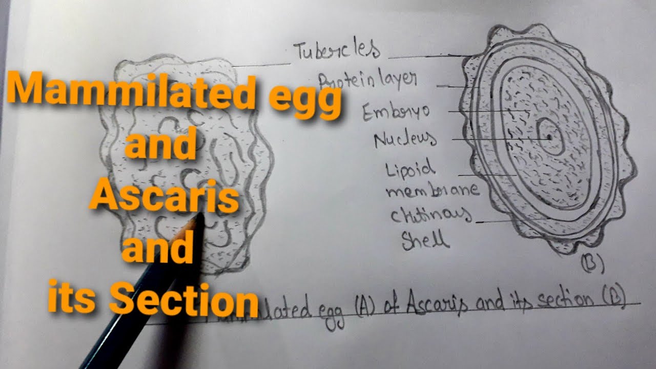 How to draw A. Mammilated egg B. Ascaris and its section //diagram very easy way.
