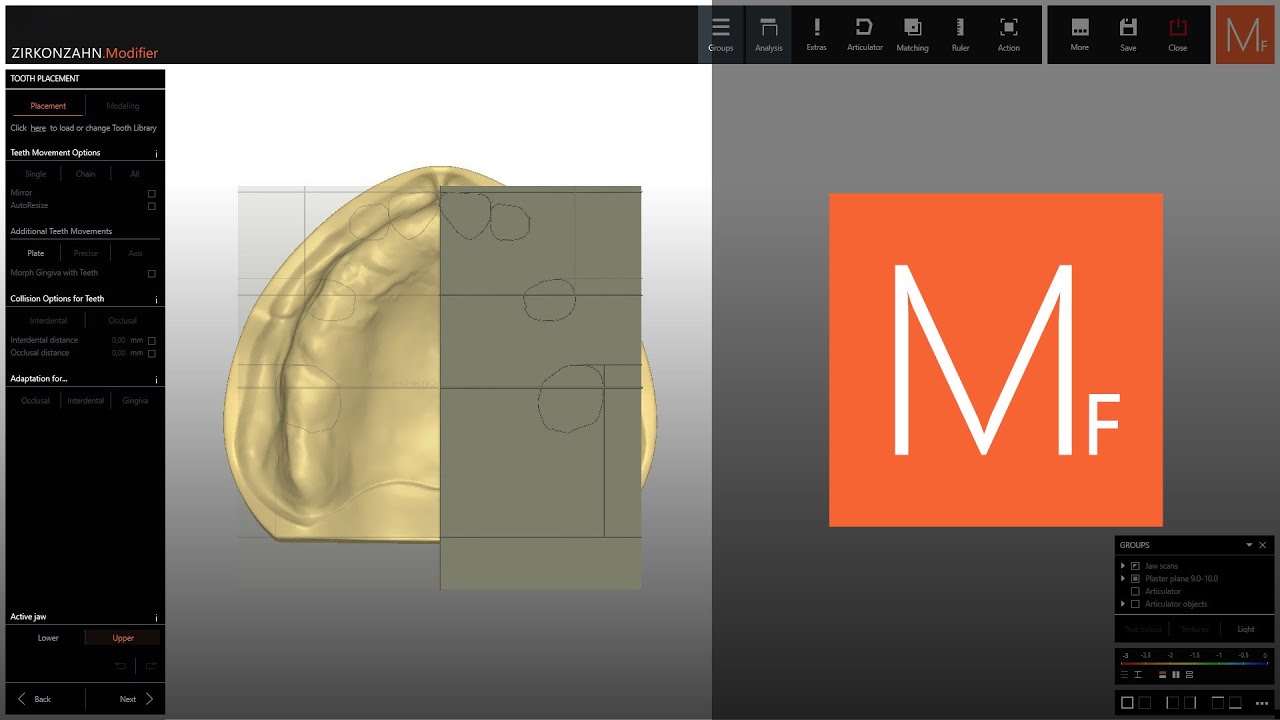 Tooth Setup Precision in Every Detail | Zirkonzahn.Modifier