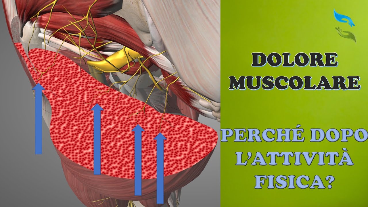 Dolore muscolare il giorno dopo l'allenamento? Non &egrave; l'acido lattico