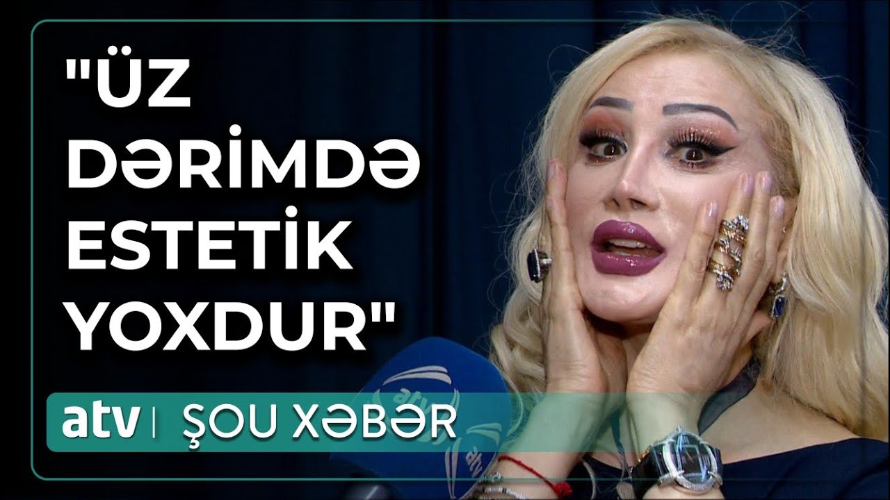 Gecə - gündüz yeyirəm, diyeta saxlamıram: Aktrisadan açıqlama - Şou Xəbər