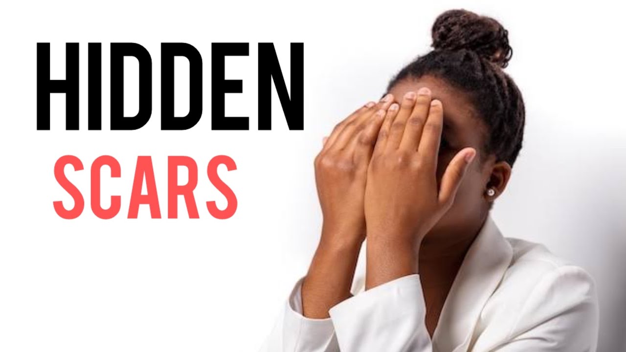 Hidden Scars: Part 1 #lovestory