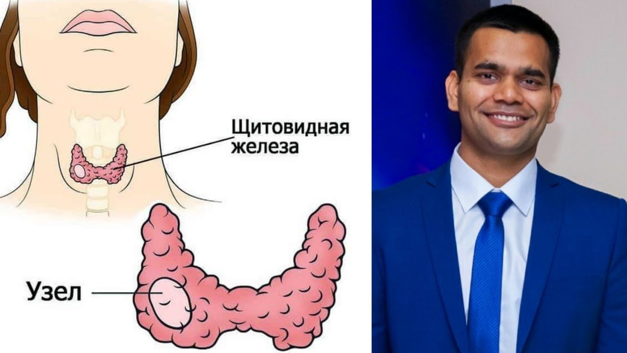 Щитовидка придёт в норму, избавитесь от узлов/киста на Щитовидной железе