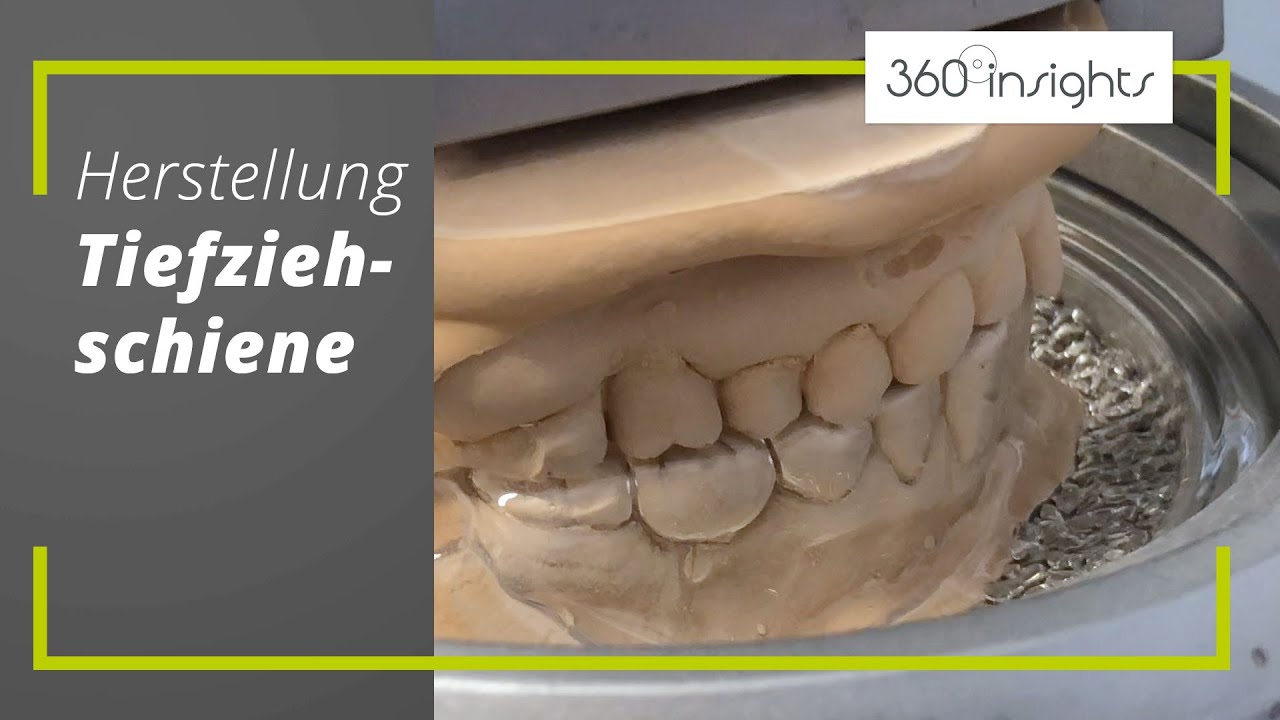 Tiefziehschiene Herstellung | 360°zahn insights