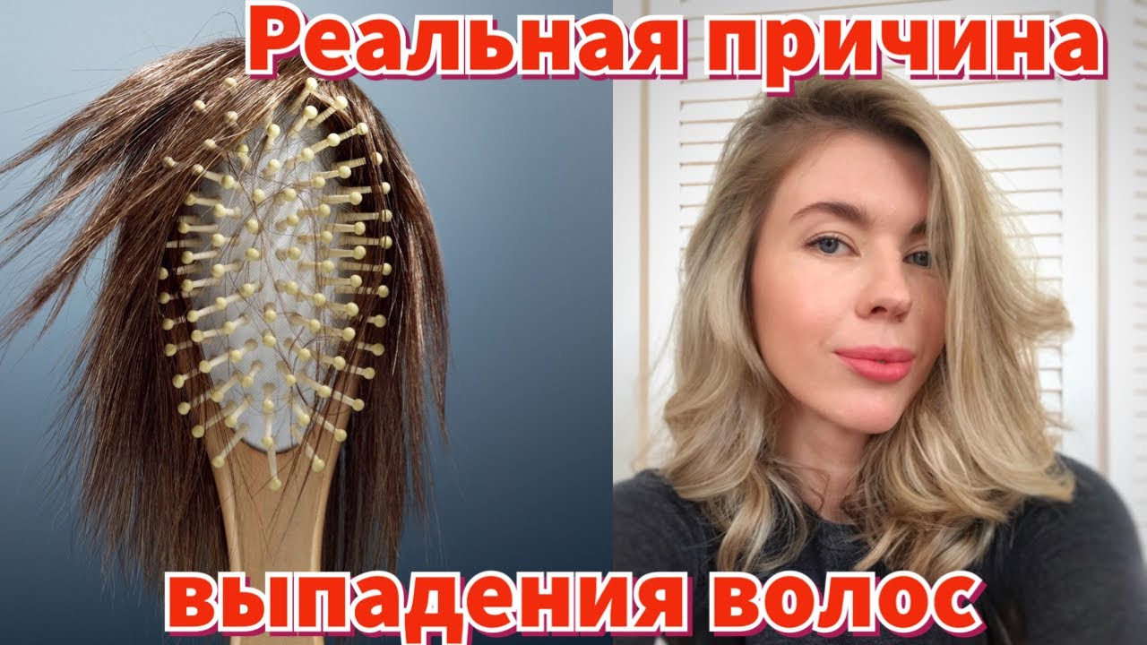 Как я справилась с сильным выпадением волос. Домашние маски, витамины, лечебные средства помогают?