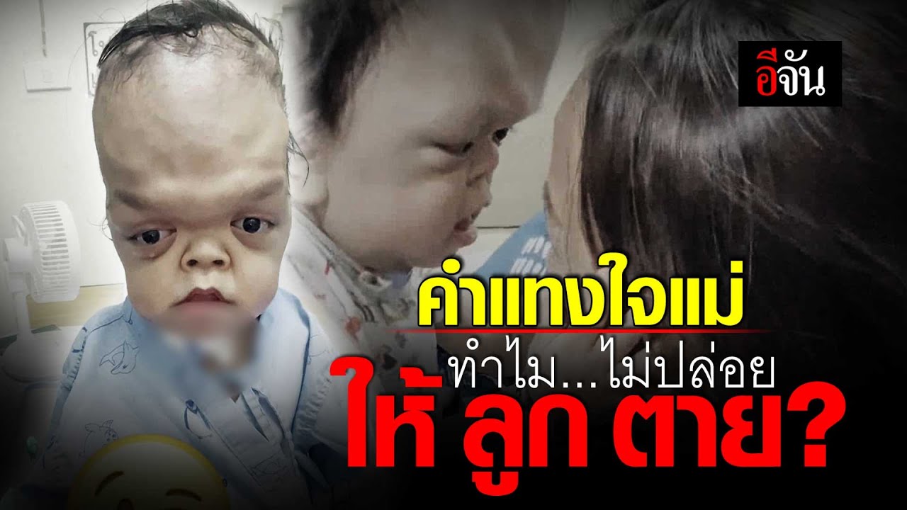 ฟังหัวอกคนเป็นแม่ ลูกเกิดมาพิการ แม่ยื้อชีวิตลูกให้รอด กลับมาเจอคำพูดทำร้ายจิตใจ | อีจัน EJAN