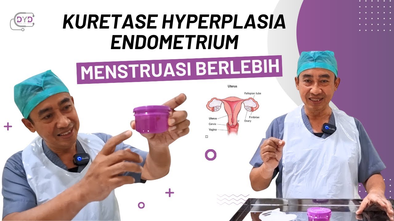 Kuretase Hyperplasia Endometrium | Menstruasi Berlebih