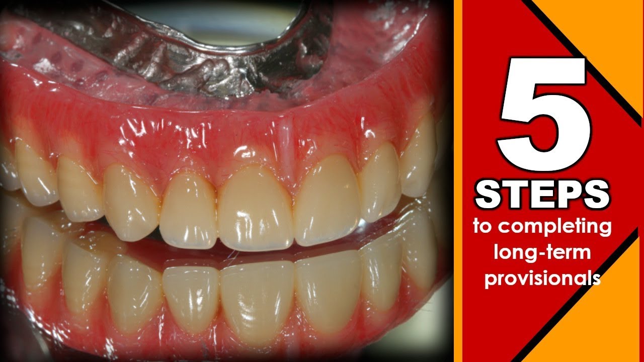 5 Steps to Completing Long-Term Provisionals