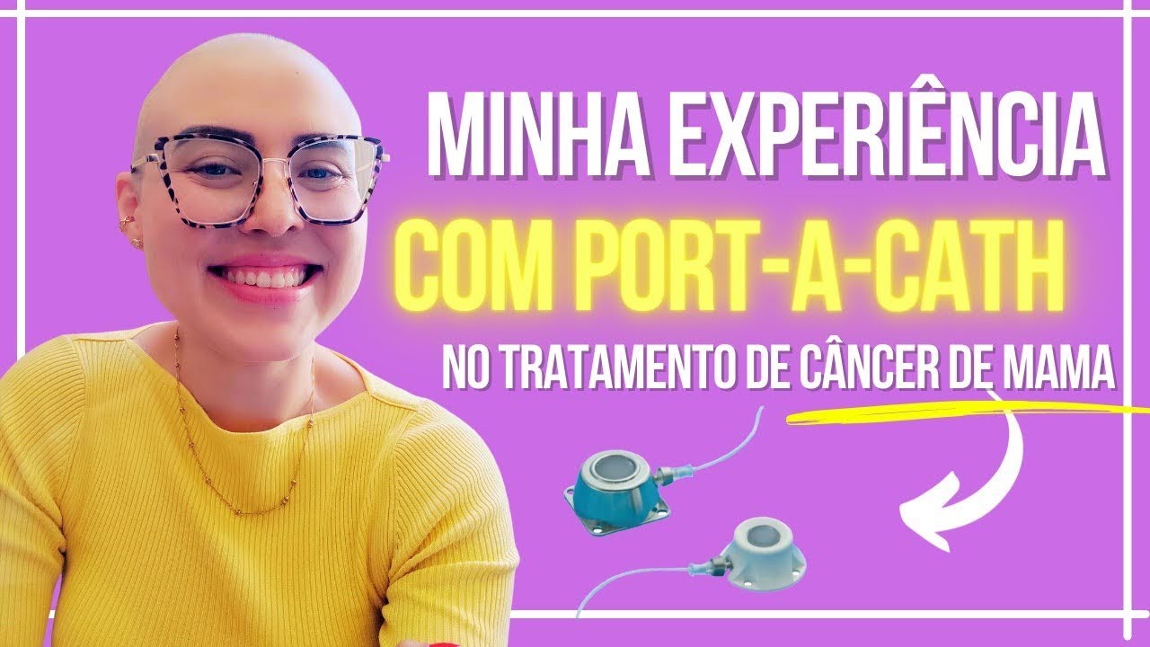 Minha experiência com o Port-a-cath/cateter no tratamento de câncer de mama