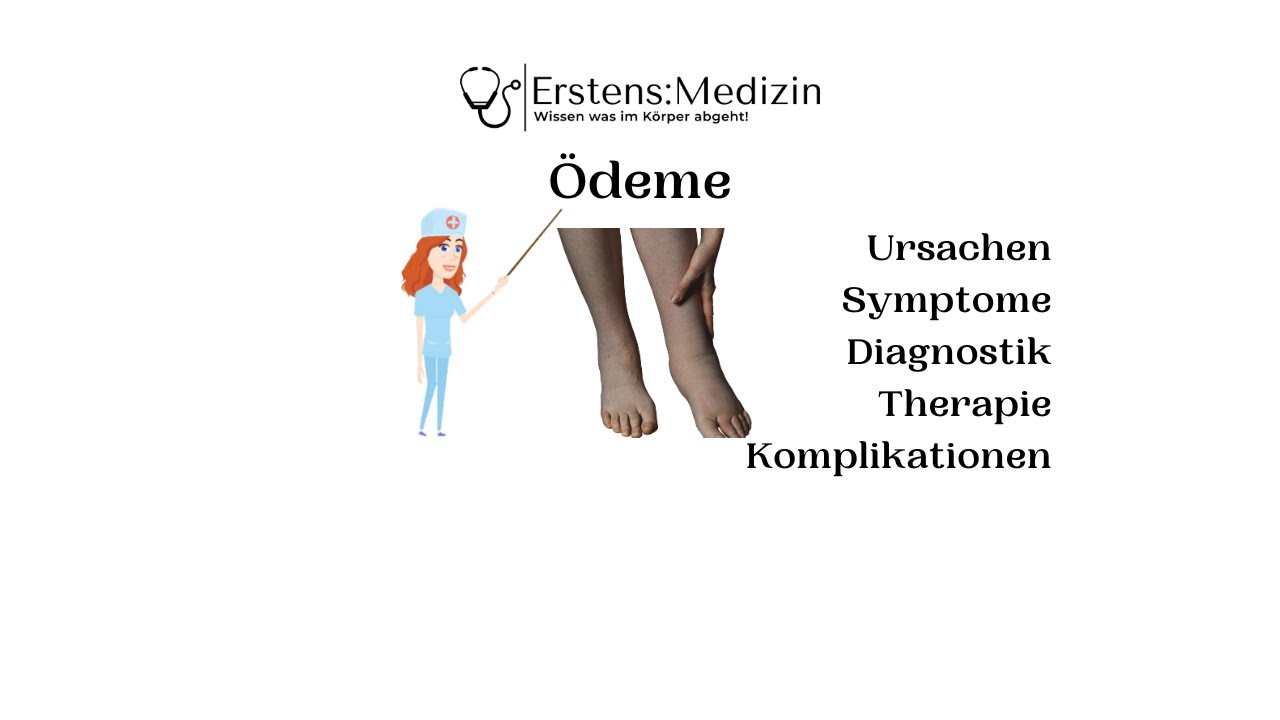 Ödem