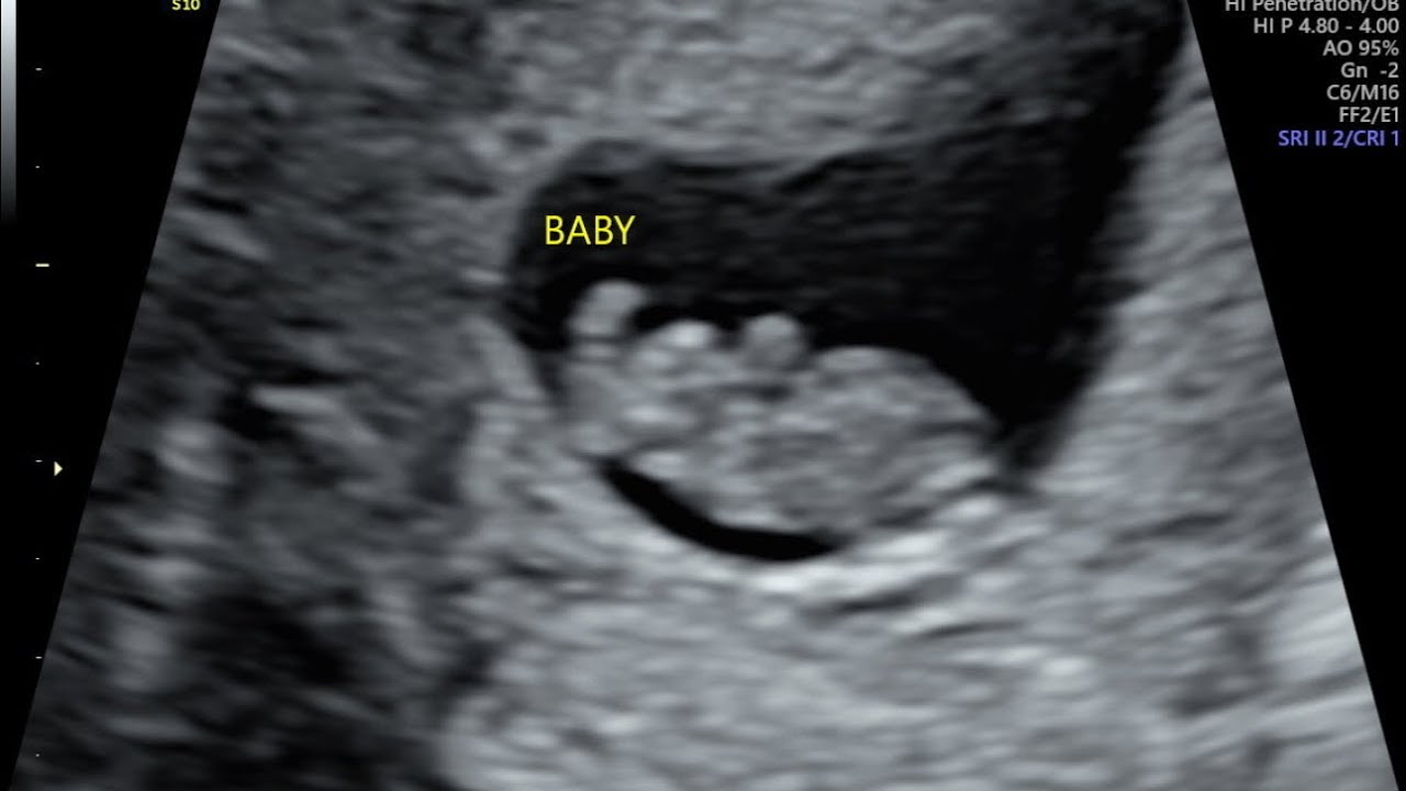 First Trimester Vlog 🍼👶