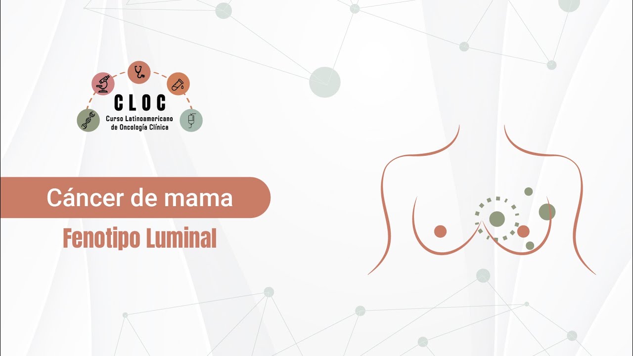 Cáncer de mama - Fenotipo Luminal