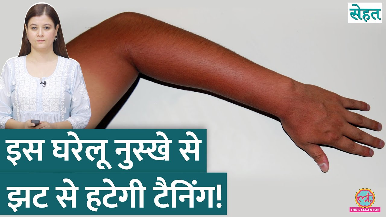 Summer में Skin Tanning से परेशान? डॉक्टर ने बताए असरदार घरेलू नुस्खें | Sehat ep 1142