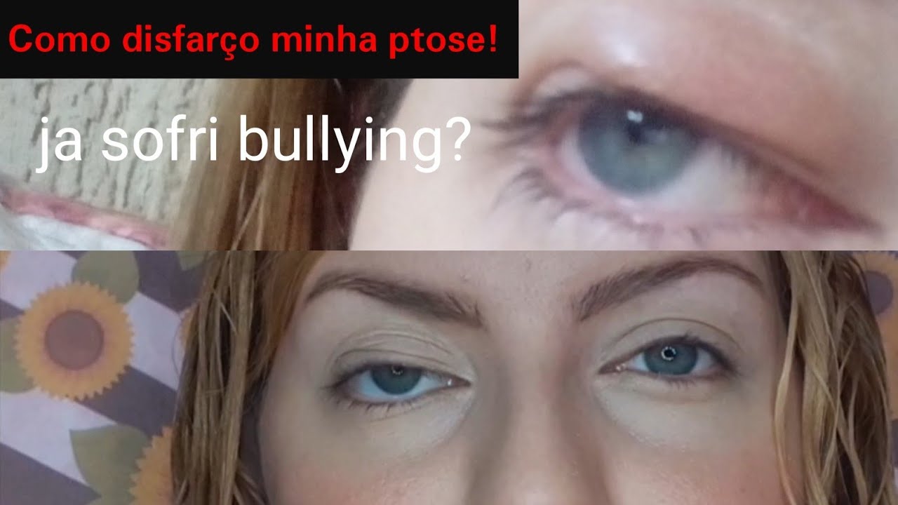 COMO MAQUIAR OLHO COM PTOSE PALPEBRAL E EXCESSO DE PELE#Maquiaefala