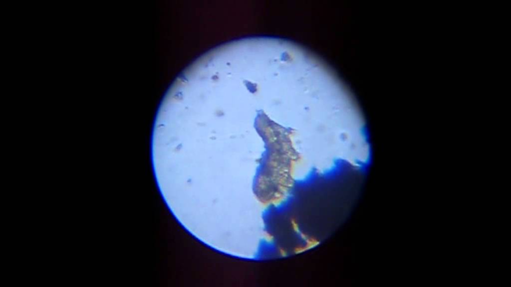 Tardigrade viewed through a cheap microscope