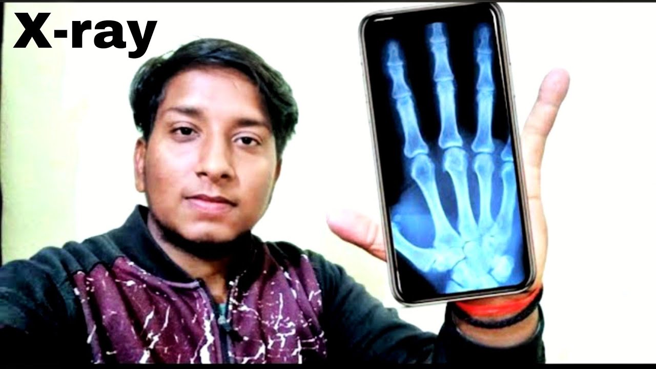 i tried X-ray with Mobile Camera |Time waste App | Must Try |