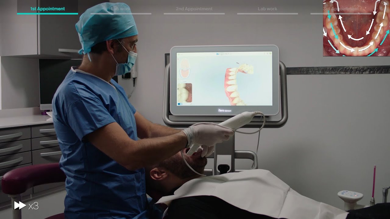 iTero Denture Digital Workflow with Dr. Olivier Boujenah
