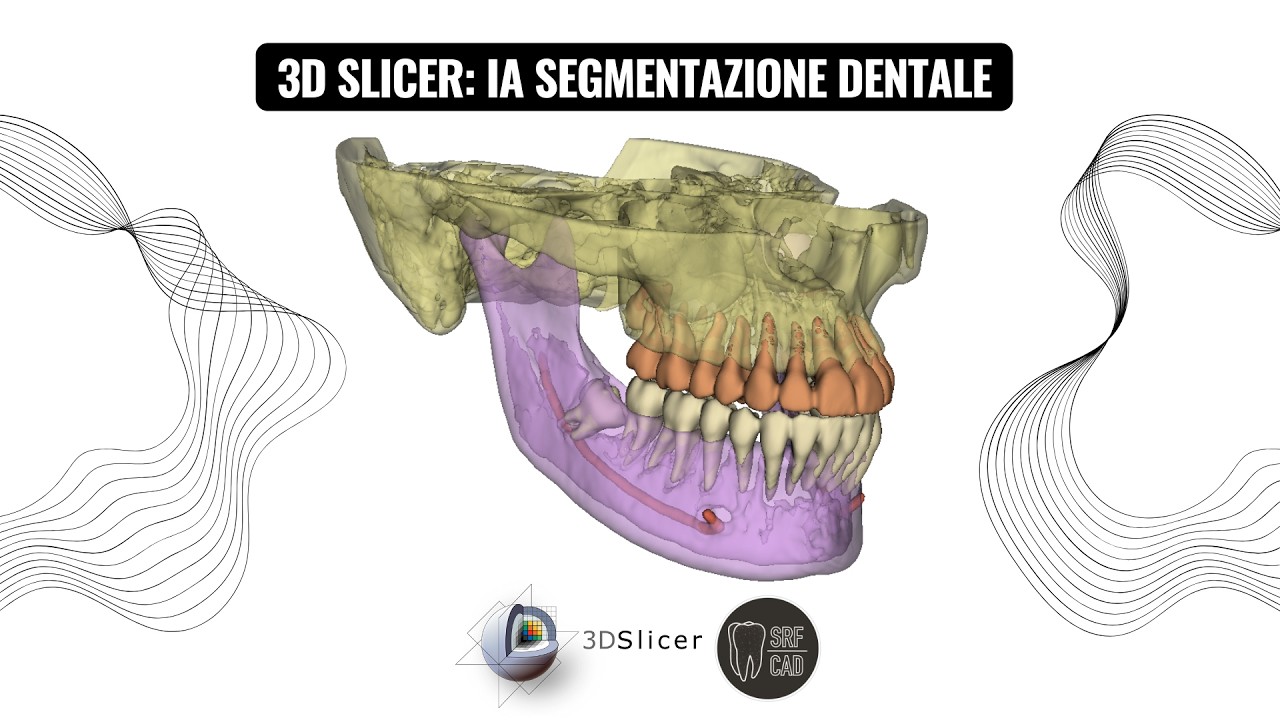 3D SLICER: IA SEGMENTAZIONE DENTALE TUTORIAL DOWNLOAD CONFIG DENTAL SEGMENTATION MESHMIXER DENTAL