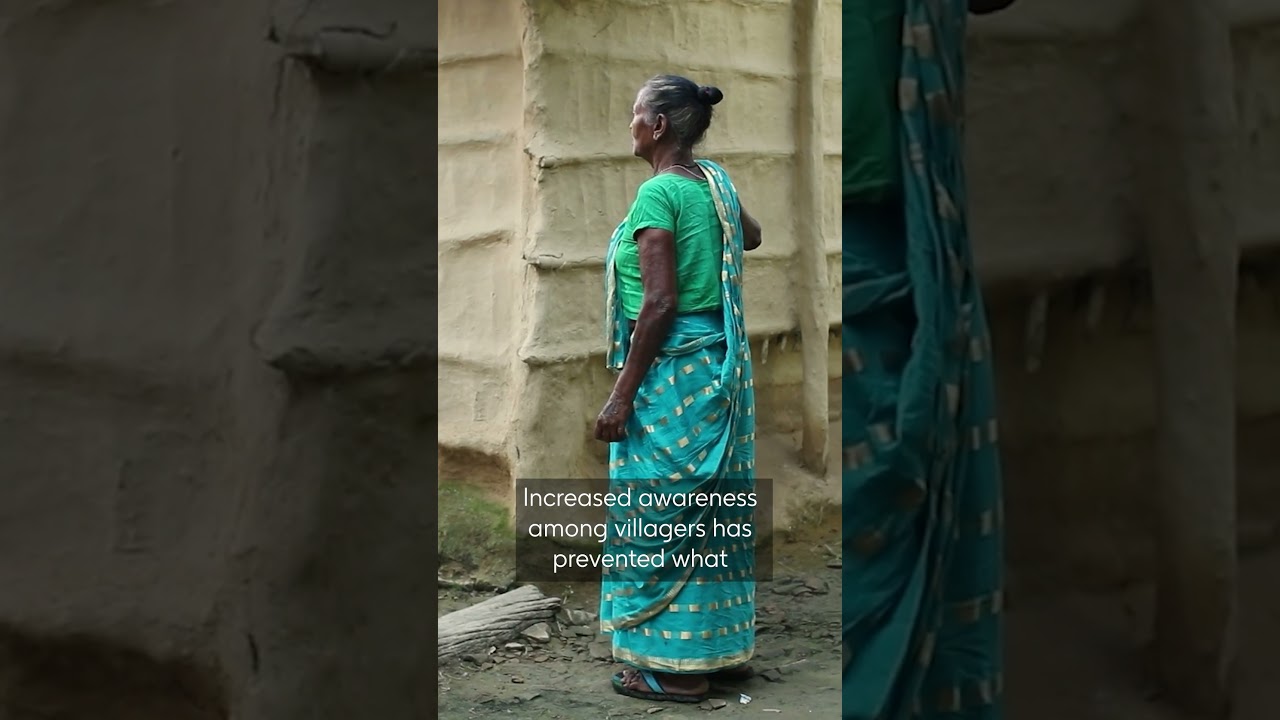 Living with lymphatic filariasis in Nepal