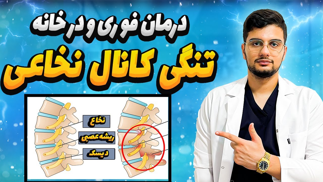 درمان تنگی کانال نخاعی فقط با 5 ورزش علمی در خانه