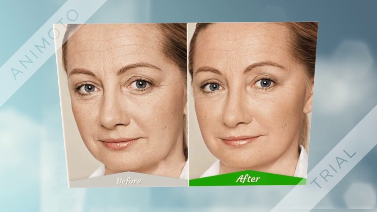 coconut oil for wrinkles under eyes