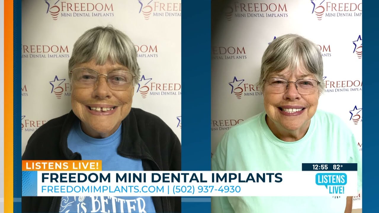 Get the Smile You Deserve at a Price You Can Afford With Freedom Mini Dental Implants. Learn More!